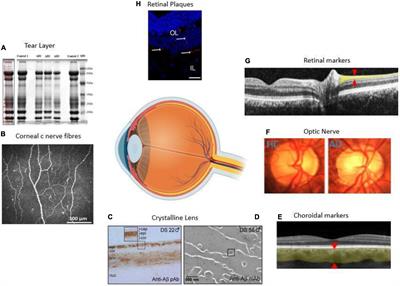 Ophthalmic Biomarkers for Alzheimer’s Disease: A Review